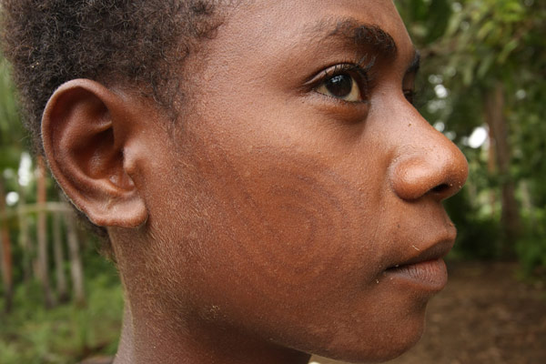 facial scarification